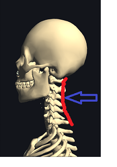 頸椎生理的前弯チームラボ.png